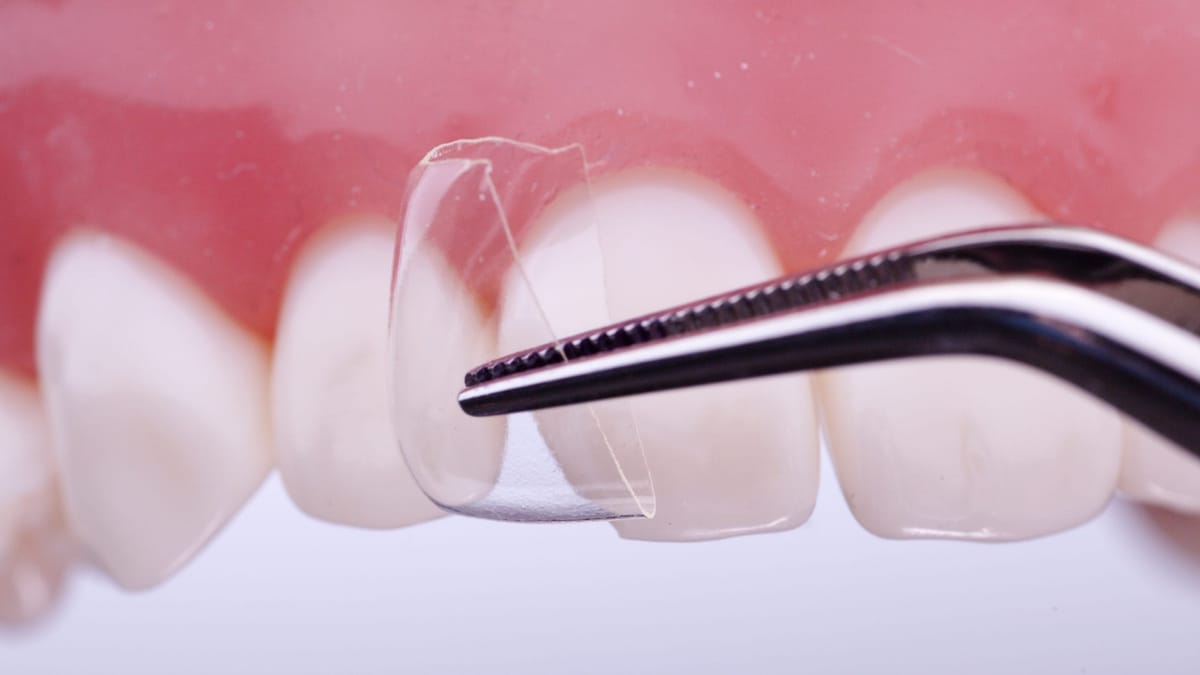 CoForm® – Directa Dental Group, Composites
