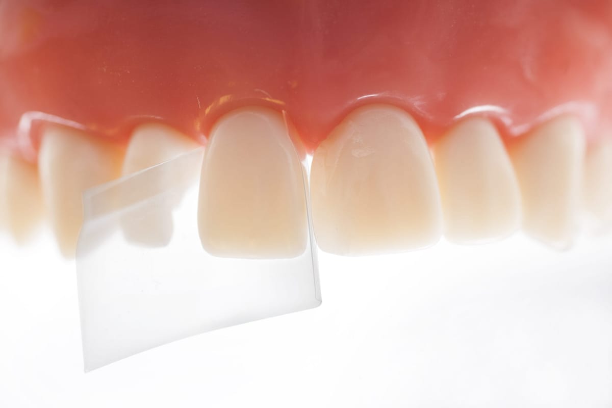 ProxyPal® – Directa Dental Group, Interdentalkeile