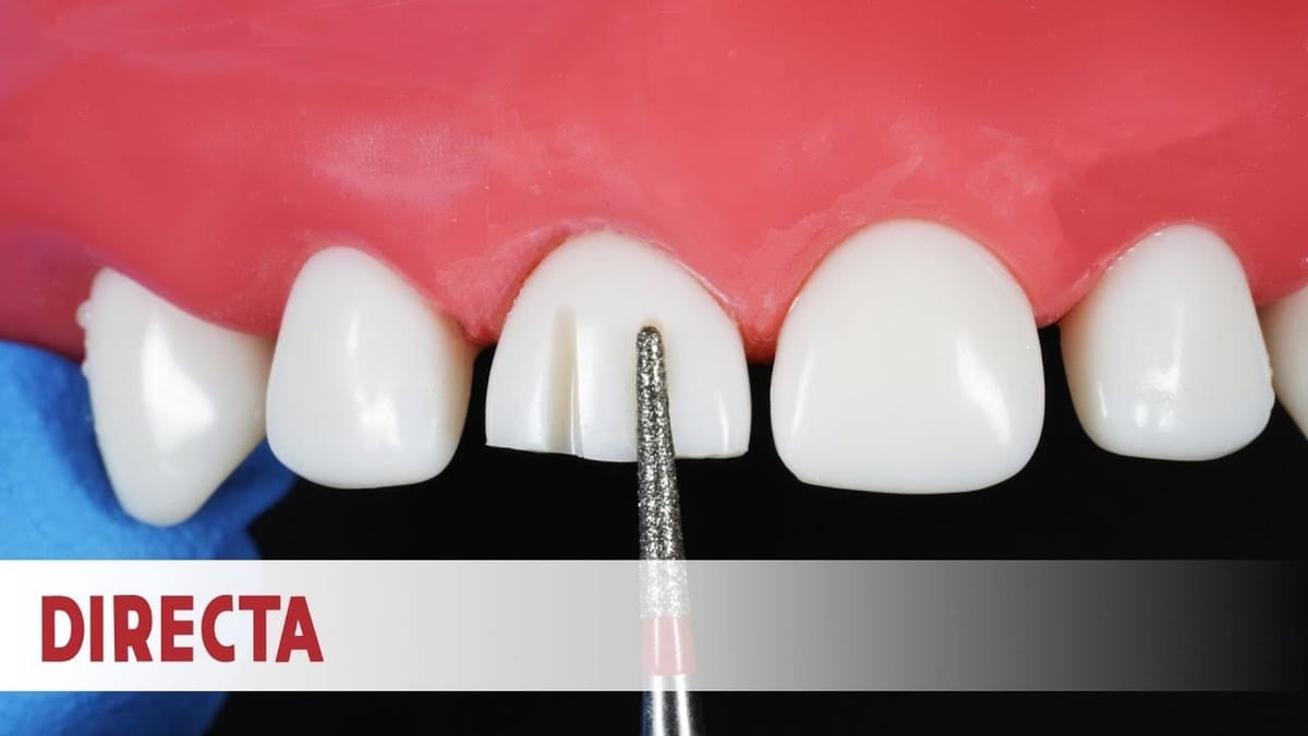 Ceramir Pediatric Crowns Kit – Directa Dental Group, Temporary Crowns