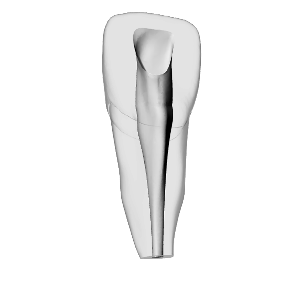 Incisor – Accessed, Narrow open apex | Dental Training Models | DRSK – DRSK Group AB, Accessories for Root Canal Treatment