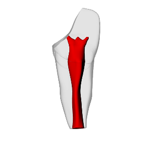 Incisor – Open apex, Pulp exposure | Dental Training Models | DRSK – DRSK Group AB, Zubehör für Wurzelbehandlung