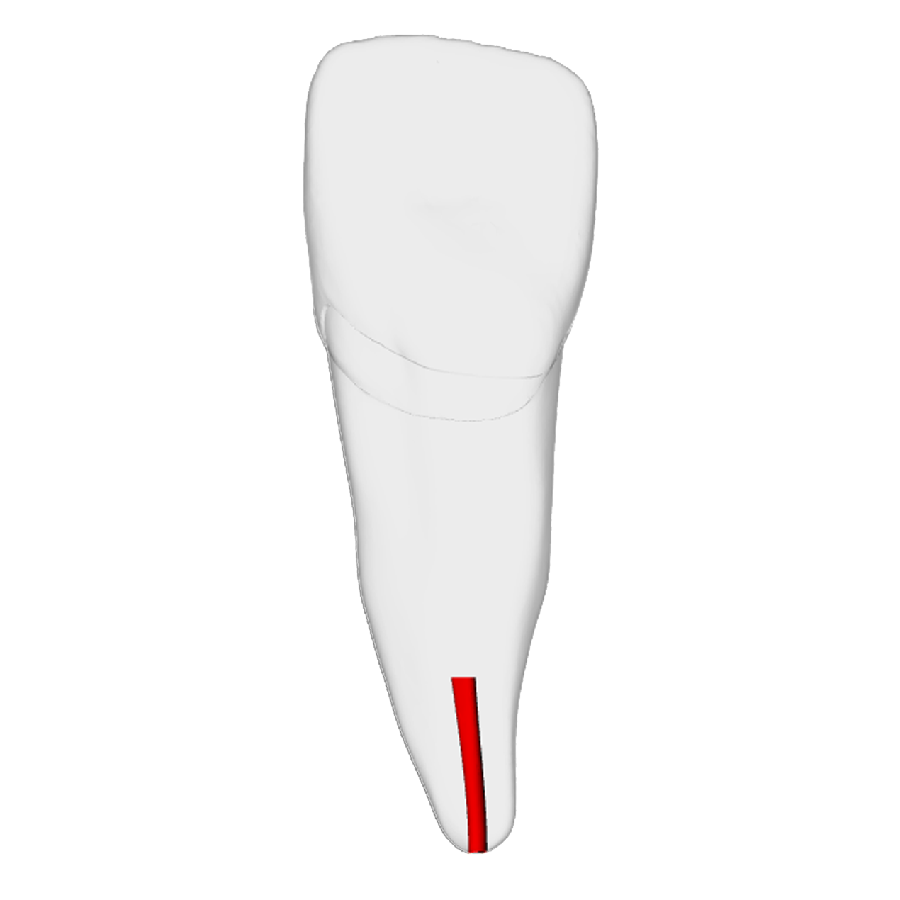 Incisor – Obliterated | Dental Training Models | DRSK