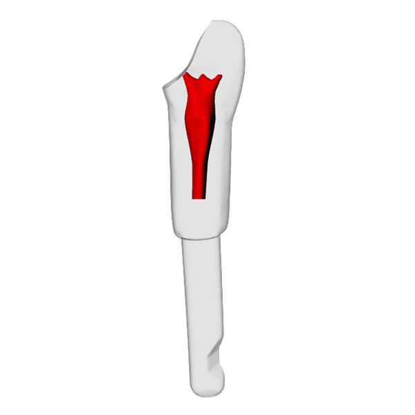 Incisor – Open apex, Pulp exposure, Kavo | Dental Training Models | DRSK