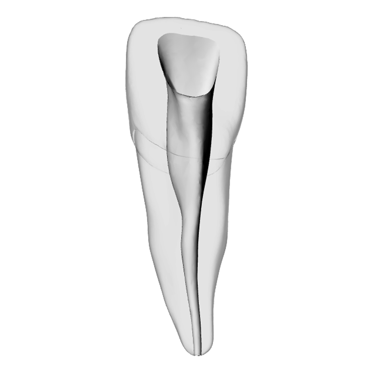 Incisor – Shaped canal, Clear | Dental Training Models | DRSK – DRSK Group AB, Zubehör für Wurzelbehandlung