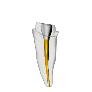 Incisor – Prepared crown, Gutta percha, Clear | Dental Training Models | DRSK – DRSK Group AB, Papierspitzen