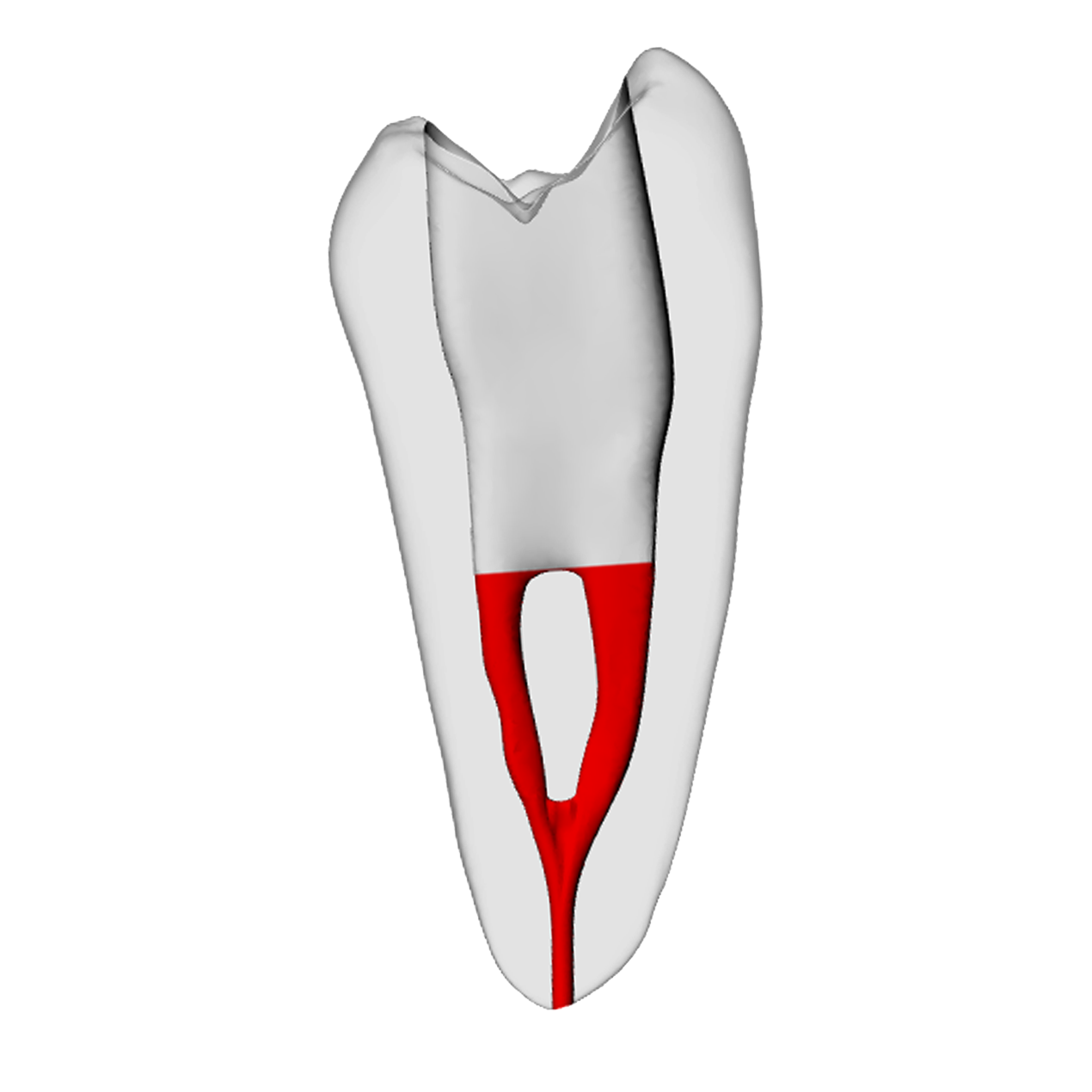 Premolar – Accessed, Merging canals, Radiopaque (White) | Dental Training Models | DRSK