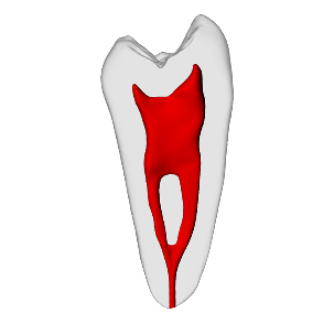 Premolar – Merging canals, Clear Root, White Crown, ~20# | Dental Training Models | DRSK