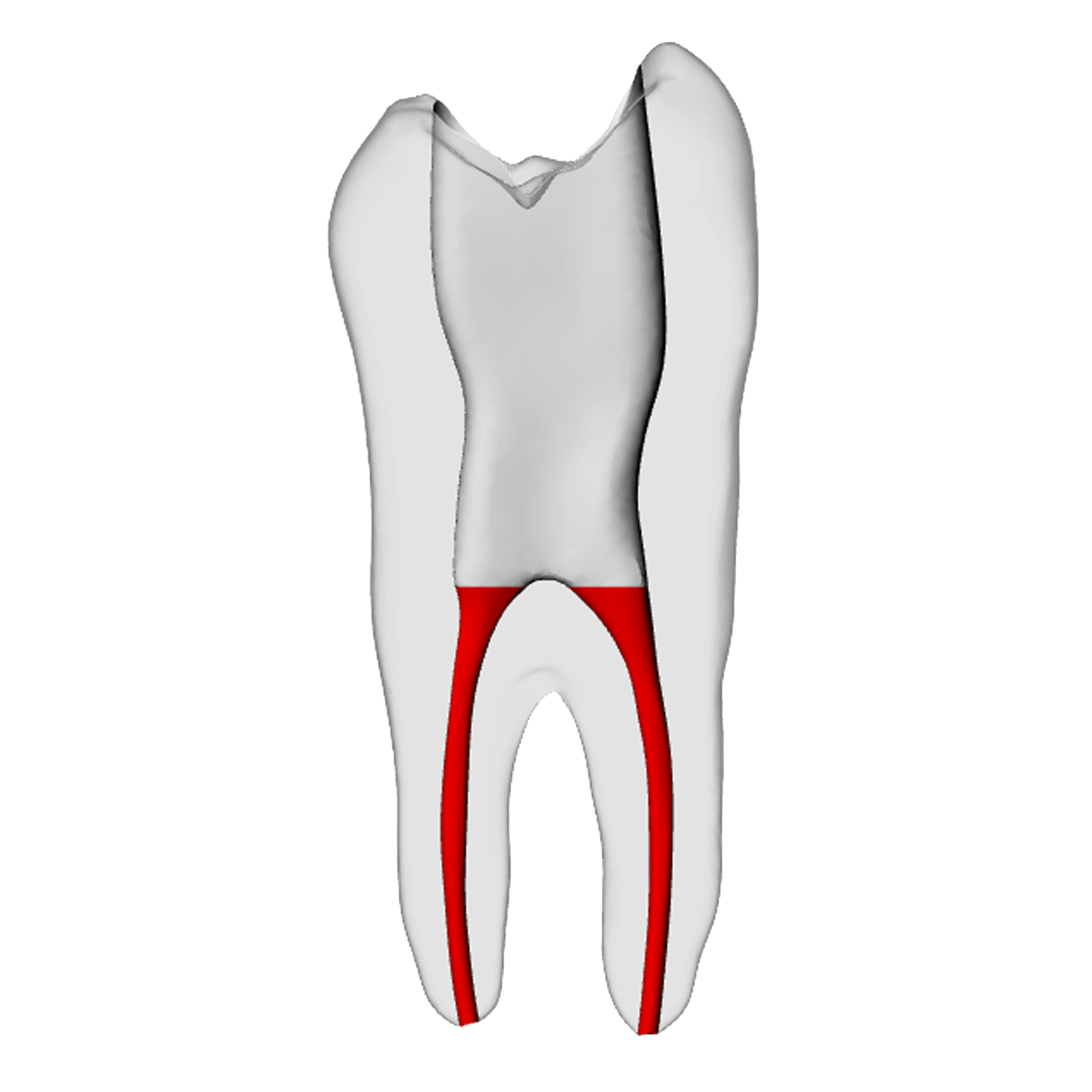 Premolar – Accessed, Basic, Radiopaque (White) | Dental Training Models | DRSK