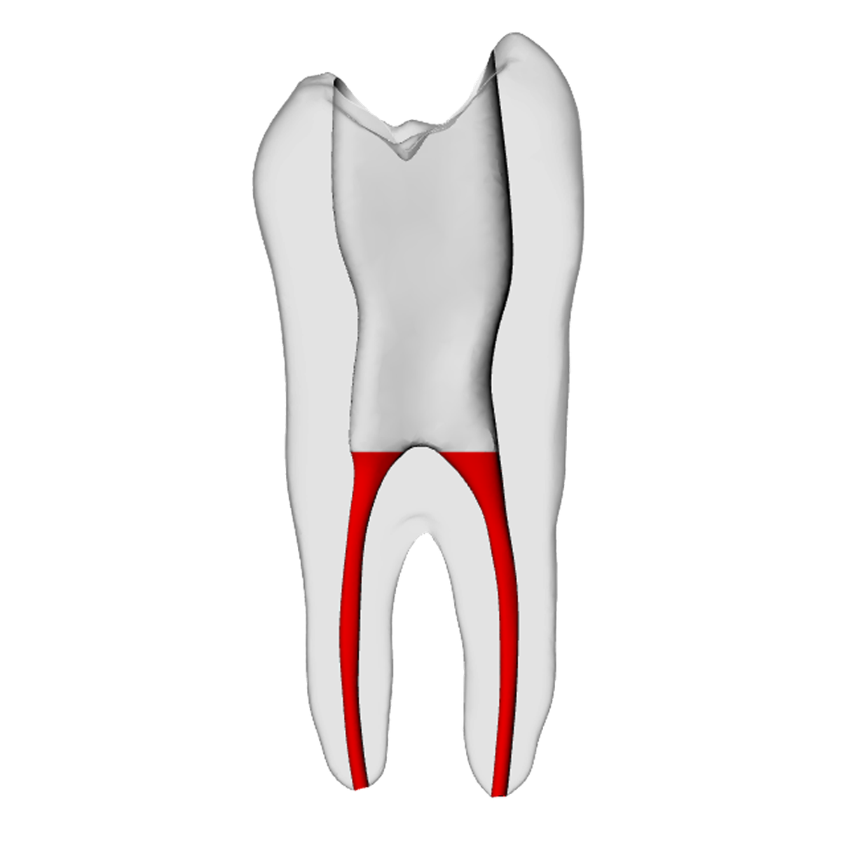 Premolar – Accessed, Basic, Radiopaque (White) | Dental Training Models | DRSK – DRSK Group AB, Zubehör für Wurzelbehandlung