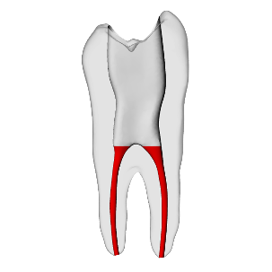Premolar – Accessed, Basic, Clear, ~20# | Dental Training Models | DRSK