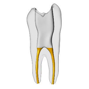 Premolar – Gutta percha, Clear | Dental Training Models | DRSK