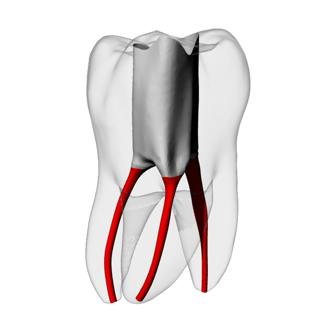 Molar – Accessed, Basic, Radiopaque (White) | Dental Training Models | DRSK