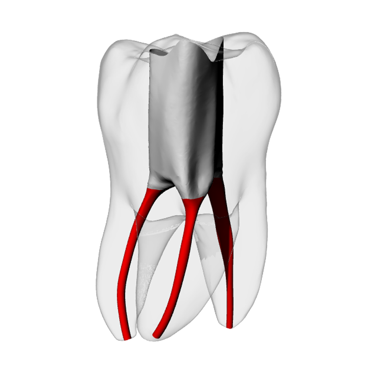 Molar – Accessed, Basic, Radiopaque (White) | Dental Training Models | DRSK – DRSK Group AB, Accessories for Root Canal Treatment