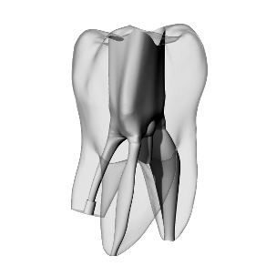 Molar, Perforated, Radiopaque (White) | Dental Training Models | DRSK