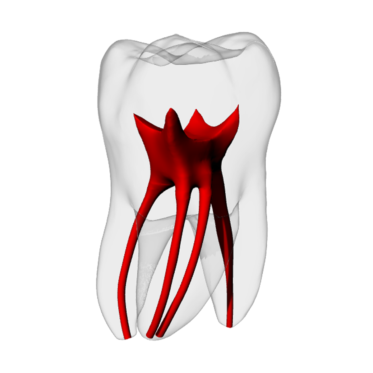 Molar – MB2, Radiopaque (White) | Dental Training Models | DRSK – DRSK Group AB, Demonstration Models
