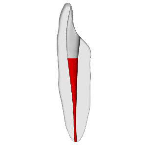 Incisor – Accessed, Basic, Clear, ~20# | Dental Training Models | DRSK – DRSK Group AB