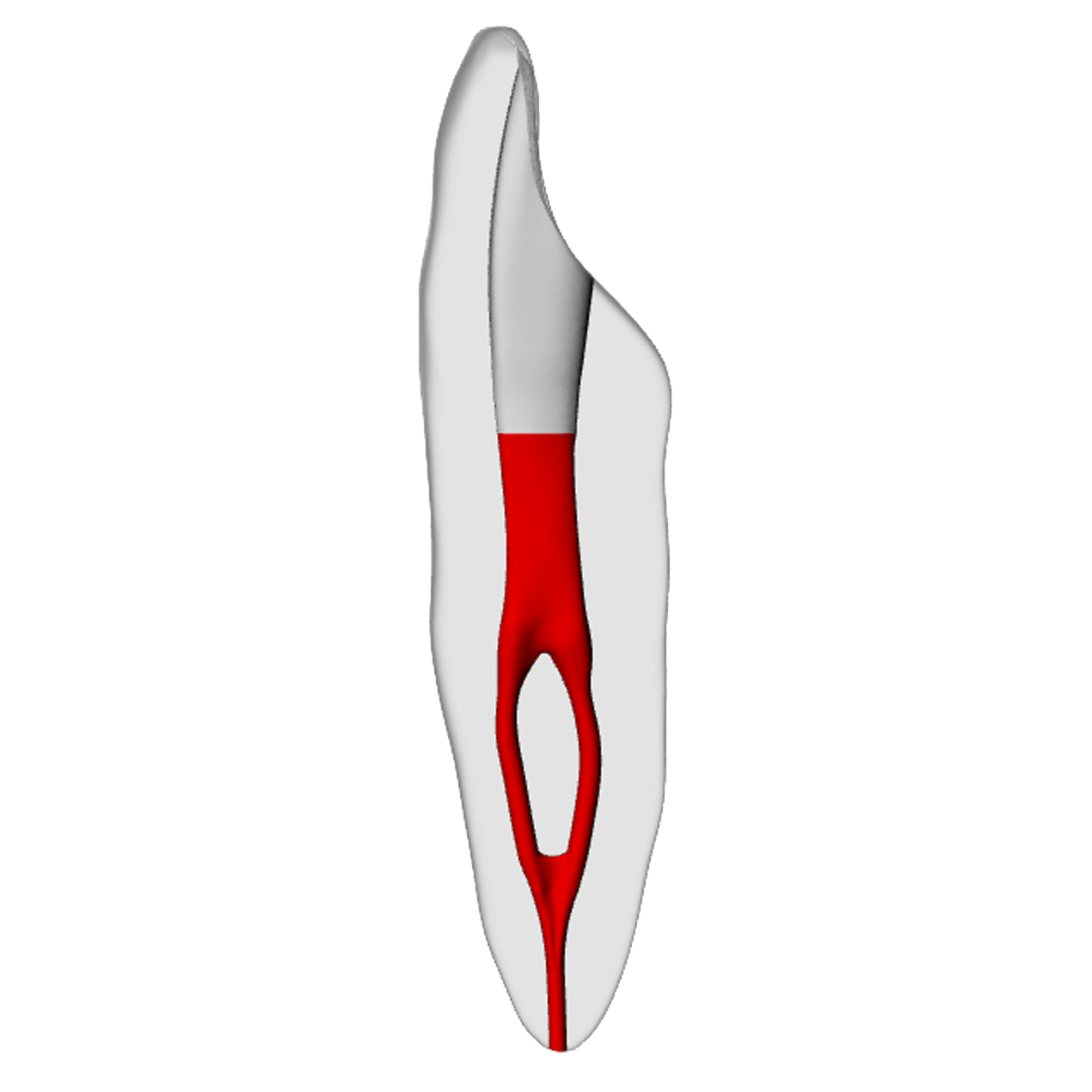 Incisor – Accessed, Merging canal, Radiopaque (White) | Dental Training Models | DRSK