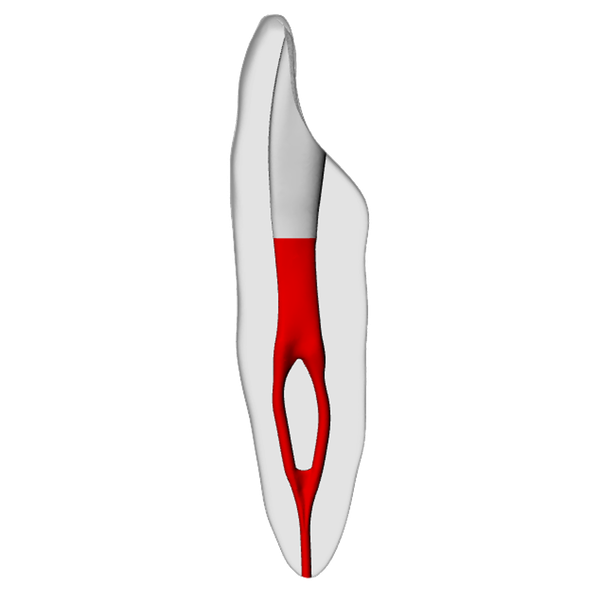 Incisor – Accessed, Merging canal, Radiopaque (White) | Dental Training Models | DRSK