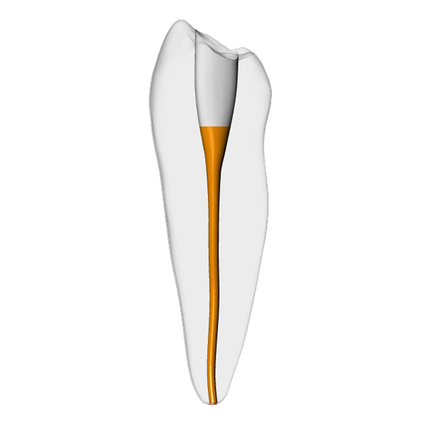 Premolar – Gutta percha, Clear | Dental Training Models | DRSK