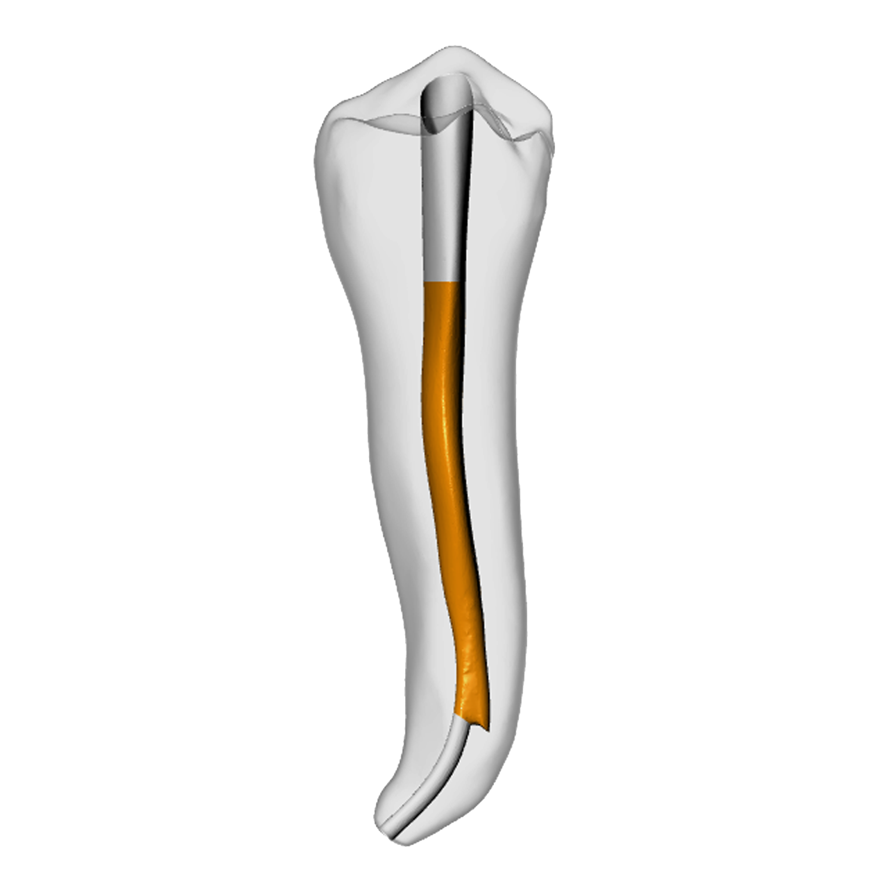 Premolar – Gutta percha, Ledge | Dental Training Models | DRSK