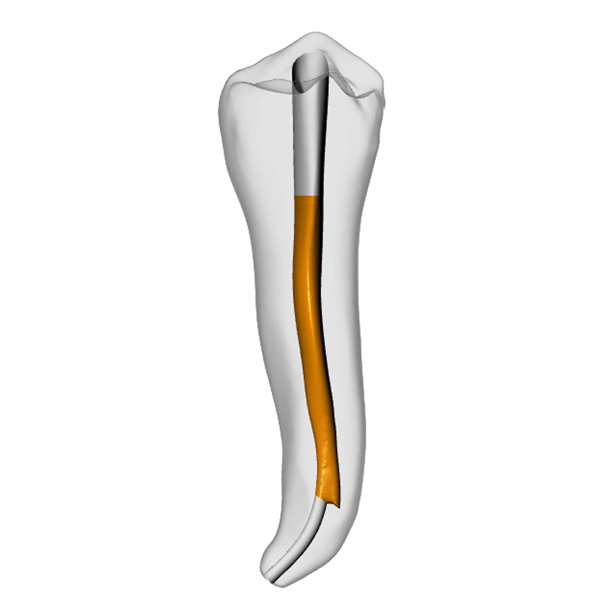 Premolar – Gutta percha, Ledge | Dental Training Models | DRSK – DRSK Group AB, Guttaperchaspitzen - Kunststoffspitzen