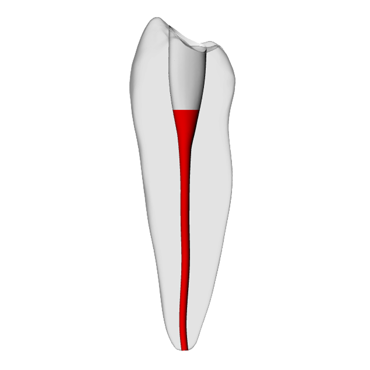 Premolar – Accessed, Basic, Radiopaque (White) | Dental Training Models | DRSK