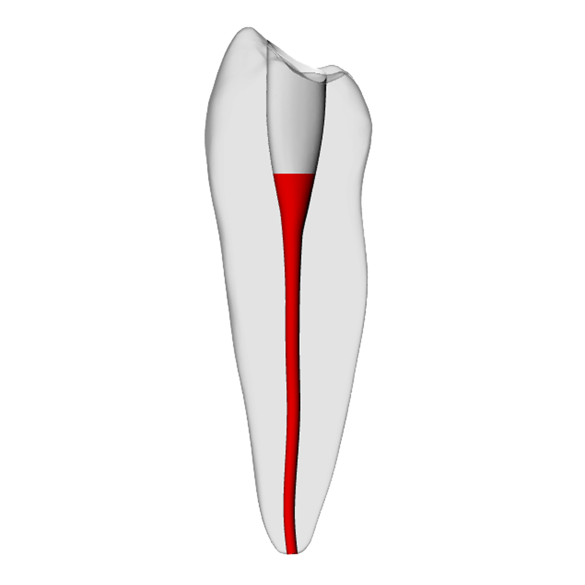 Premolar – Accessed, Basic, Radiopaque (White) | Dental Training Models | DRSK – DRSK Group AB, Zubehör für Wurzelbehandlung