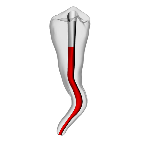 Premolar – Accessed, Dilacerated, Radiopaque (White) | Dental Training Models | DRSK