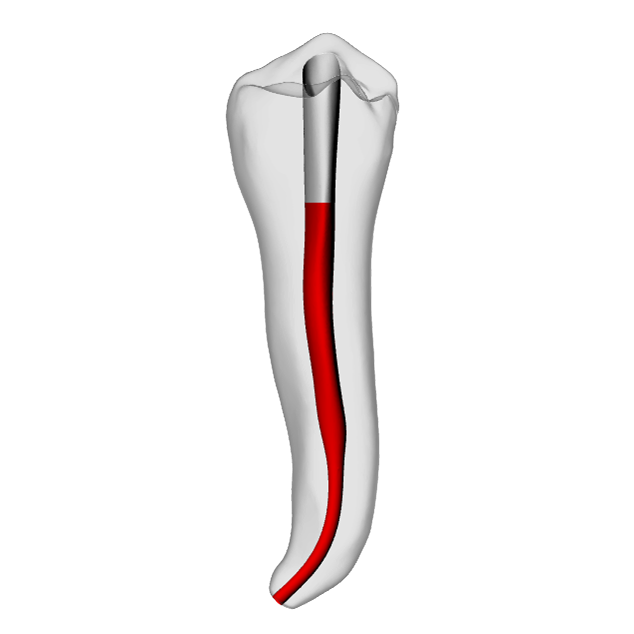 Premolar – Accessed, Apical curve, White | Dental Training Models | DRSK