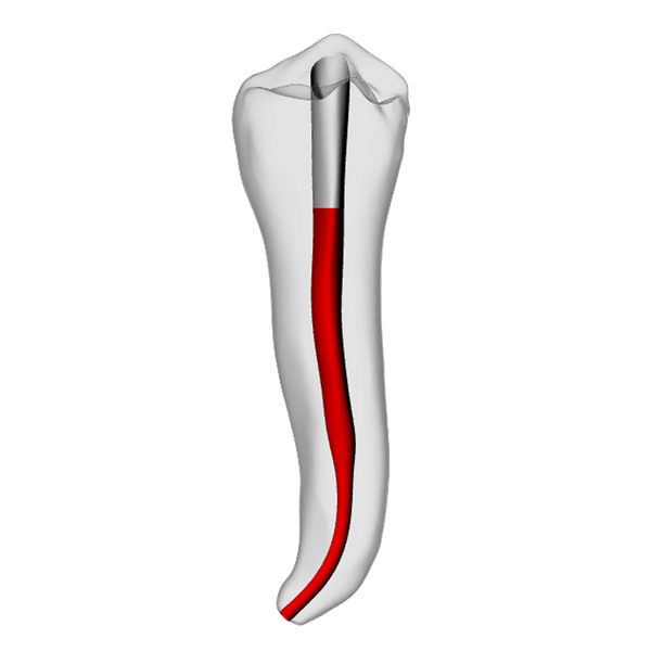 Premolar – Accessed, Apical curve, White | Dental Training Models | DRSK