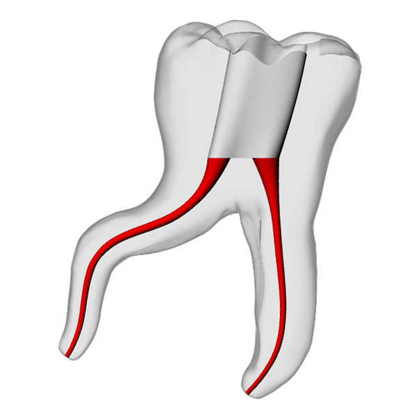 Molar – Severe Curvature 1, Clear | Dental Training Models | DRSK