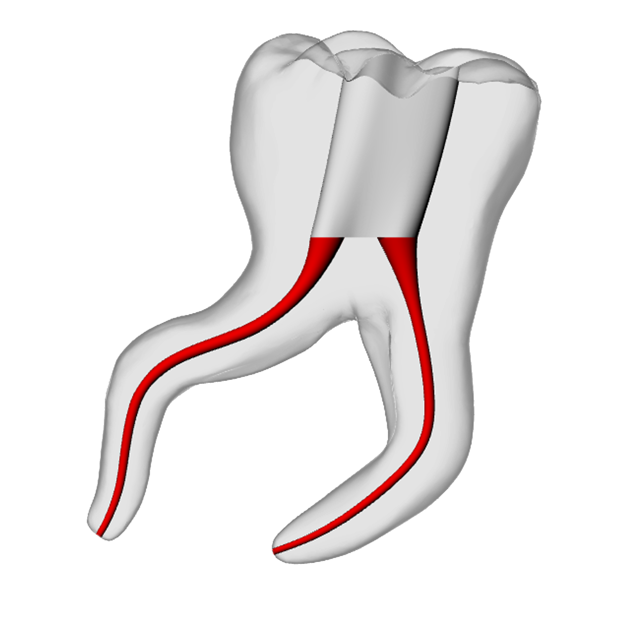 Molar – Severe Curvature 2, Clear | Dental Training Models | DRSK