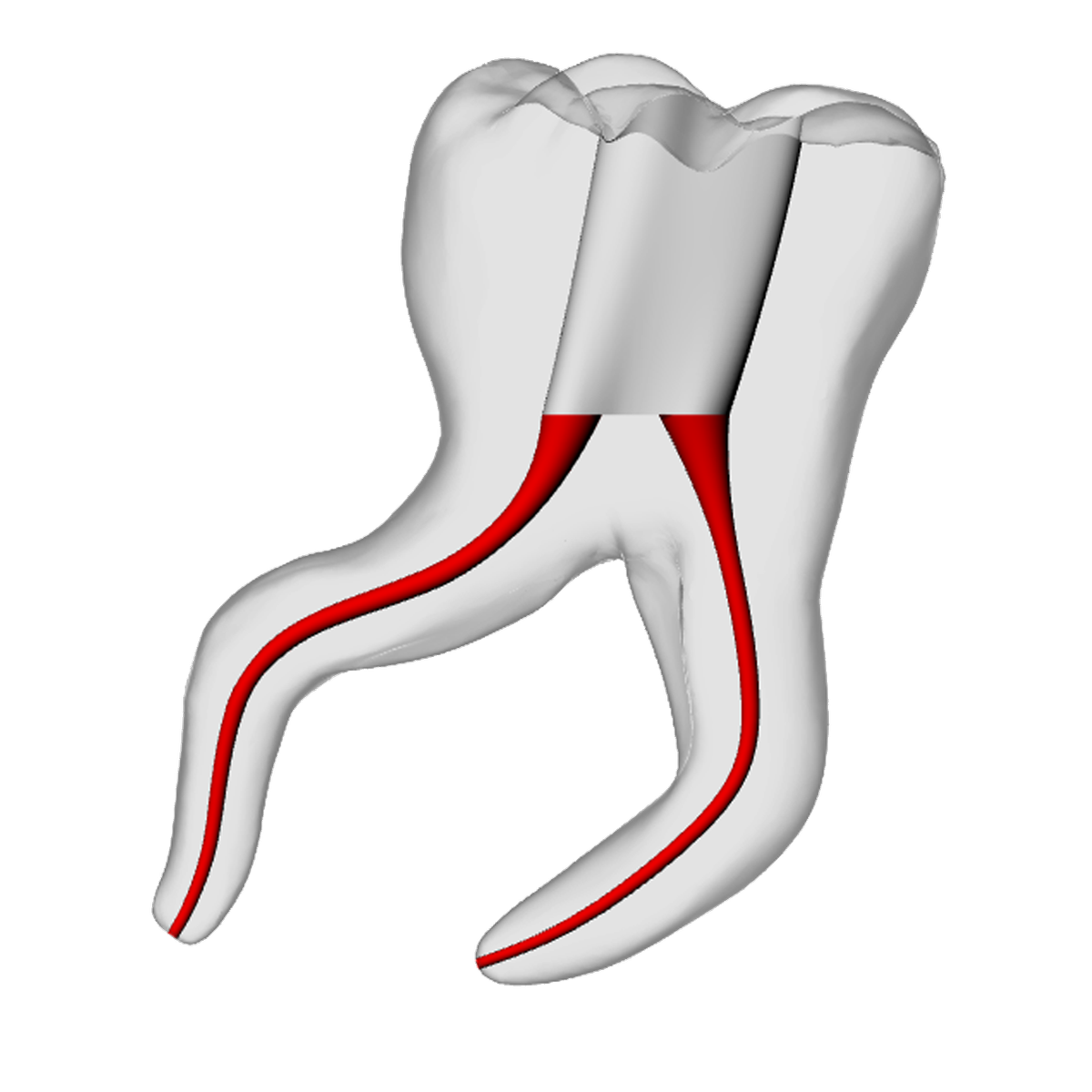 Molar – Severe Curvature 2, Clear | Dental Training Models | DRSK – DRSK Group AB, Accessories for Root Canal Treatment