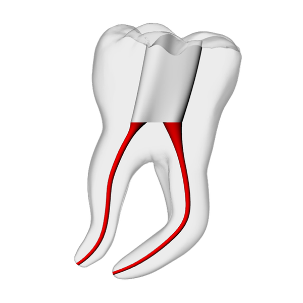 Molar – Severe Curvature 3, Clear | Dental Training Models | DRSK