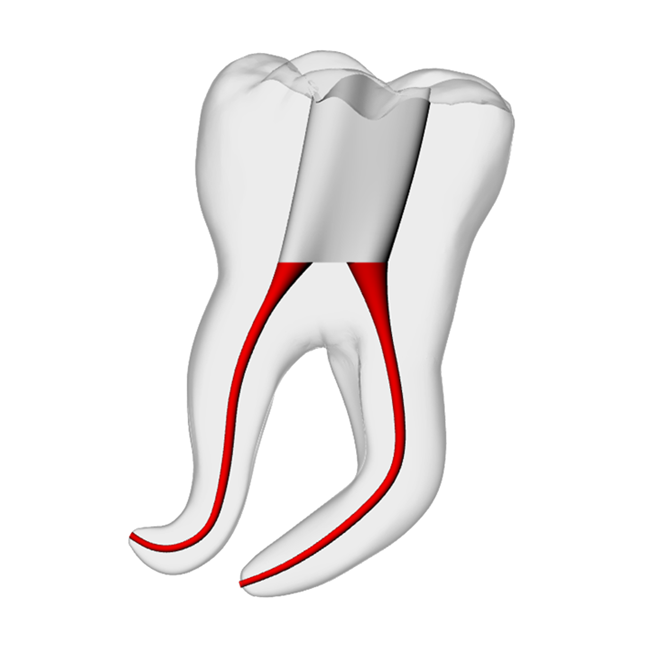 Molar – Severe Curvature 4, Clear | Dental Training Models | DRSK