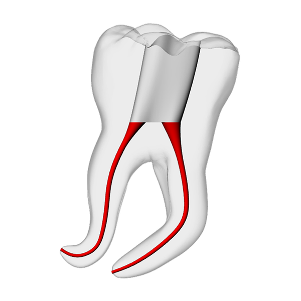 Molar – Severe Curvature 4, Clear | Dental Training Models | DRSK
