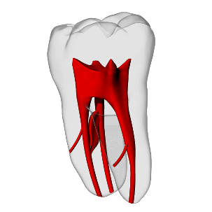 Molar – Accessory canals | Dental Training Models | DRSK – DRSK Group AB