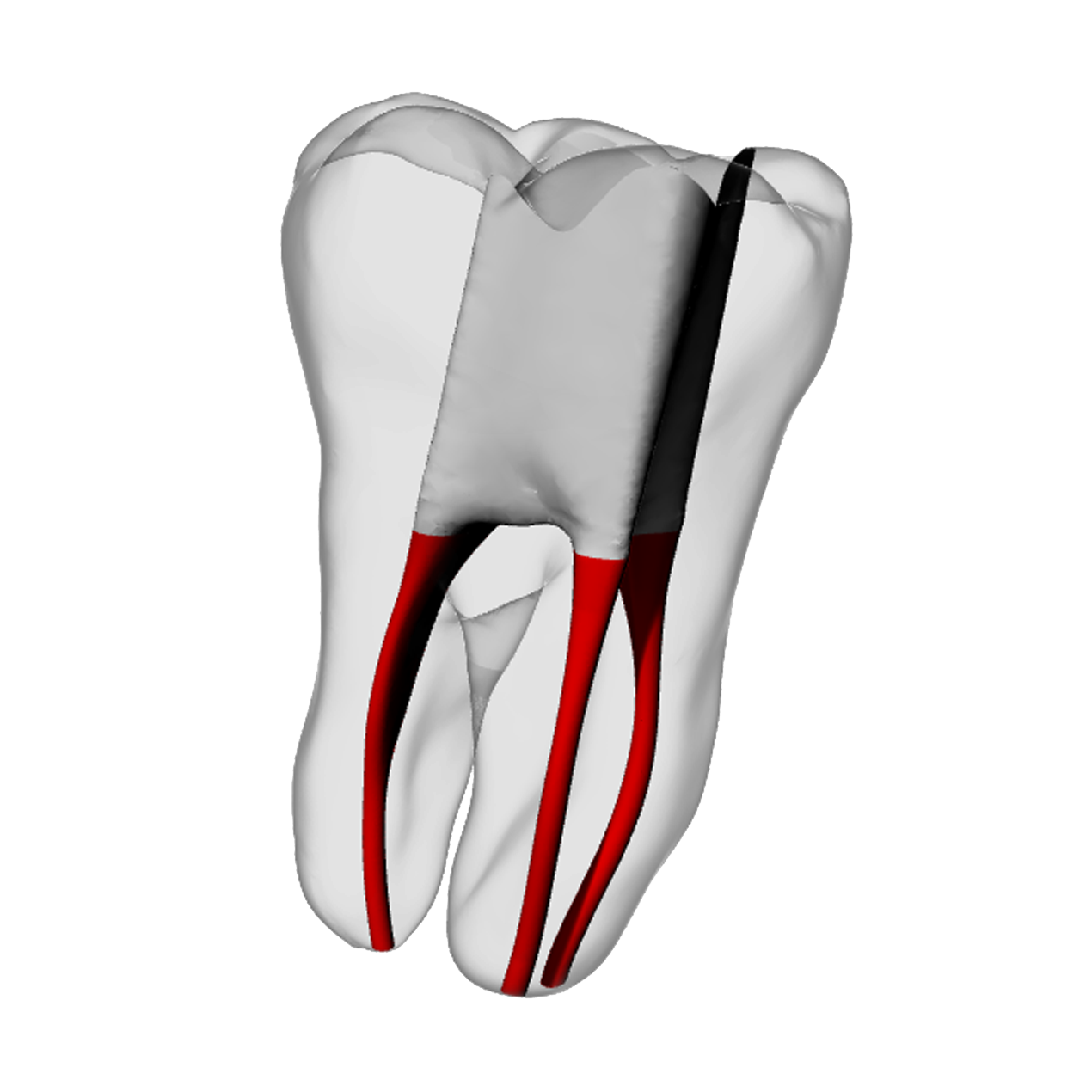 Molar – Accessed, Basic, White | Dental Training Models | DRSK – DRSK Group AB