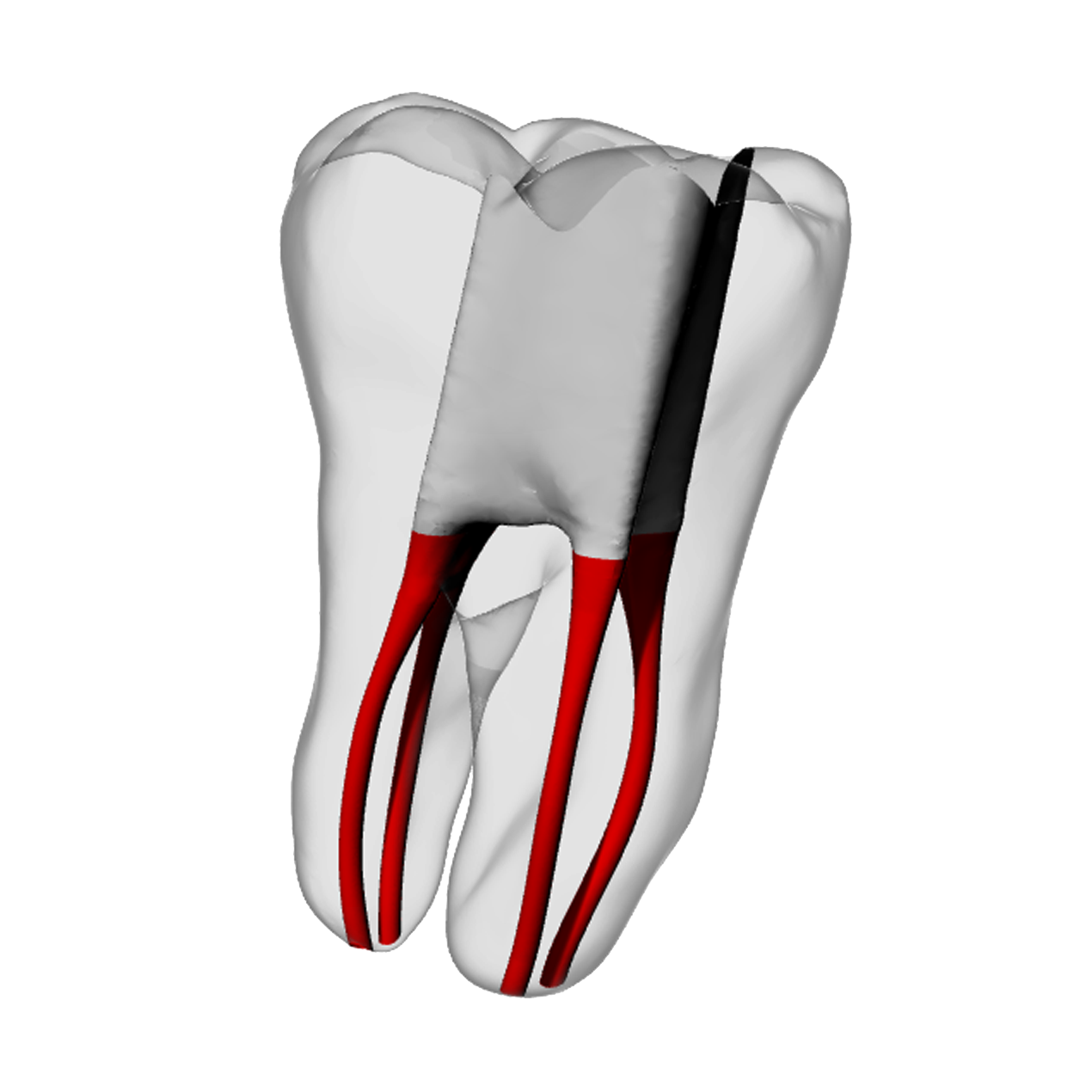 Molar – Accessed, Four canals, White | Dental Training Models | DRSK