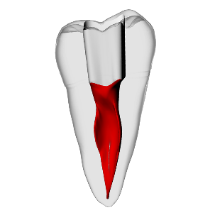 Second molar – C-Shape | Dental Training Models | DRSK – DRSK Group AB, Zubehör für Wurzelbehandlung