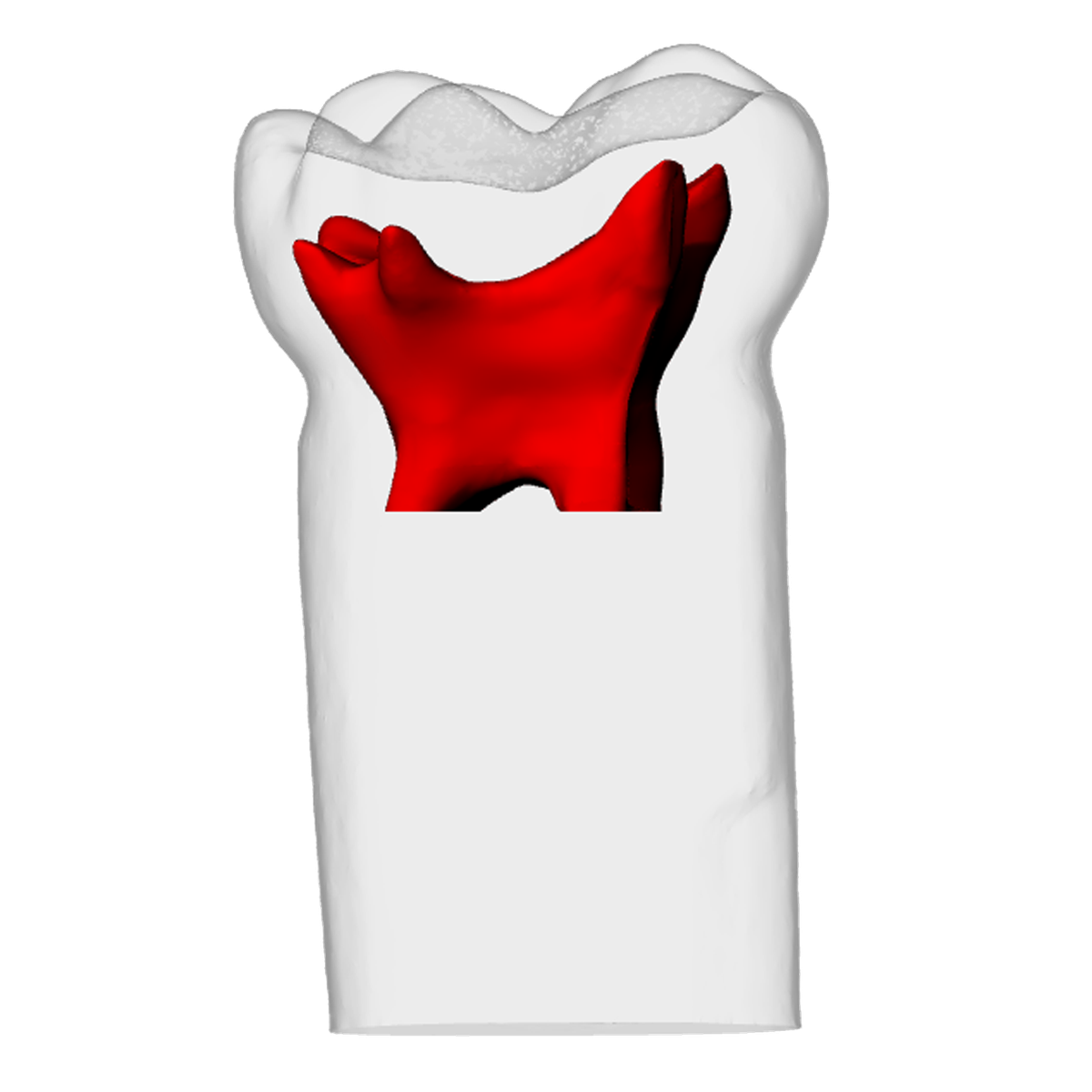 Primary mandibular second molar – DRSK Group AB, Gipszusätze, Stumpflacke und Gipslöser