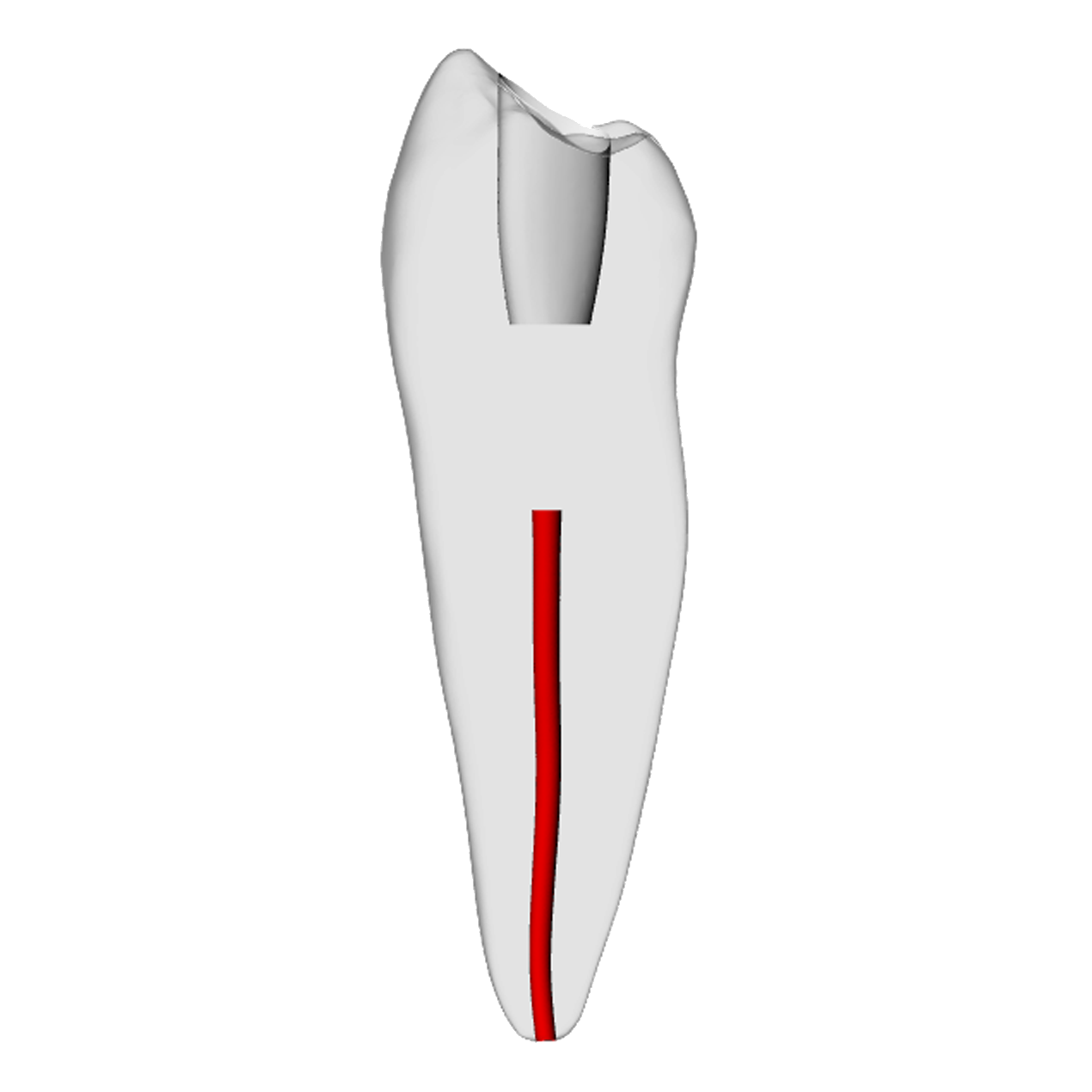 Premolar – Obliterated, Radiopaque (White) | Dental Training Models | DRSK