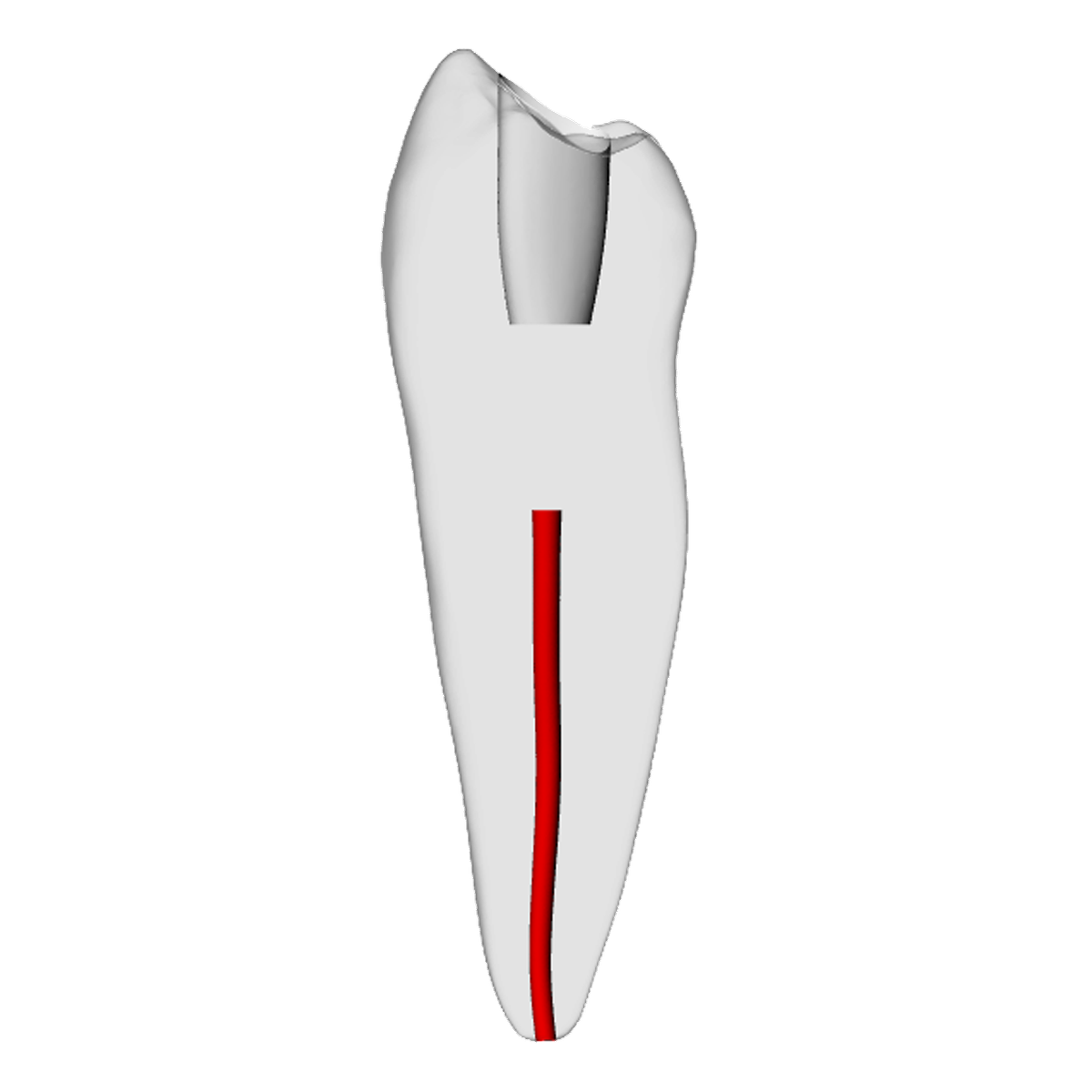 Premolar – Obliterated, Radiopaque (White) | Dental Training Models | DRSK – DRSK Group AB, Gipszusätze, Stumpflacke und Gipslöser