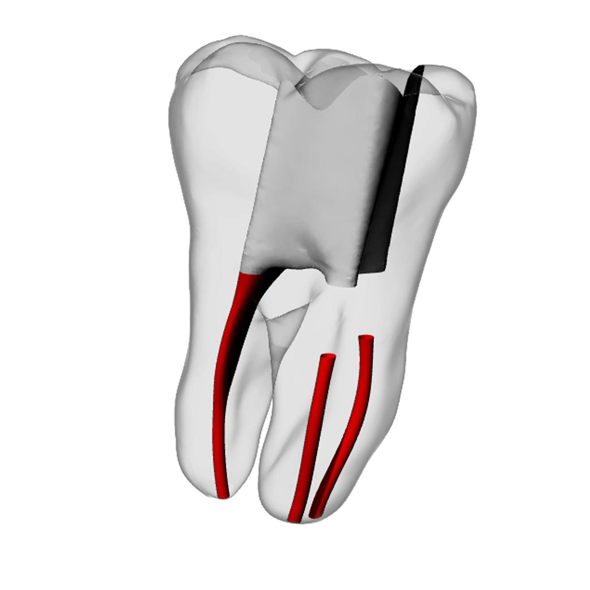 Molar – Obliterated | Dental Training Models | DRSK – DRSK Group AB, Zubehör für Wurzelbehandlung