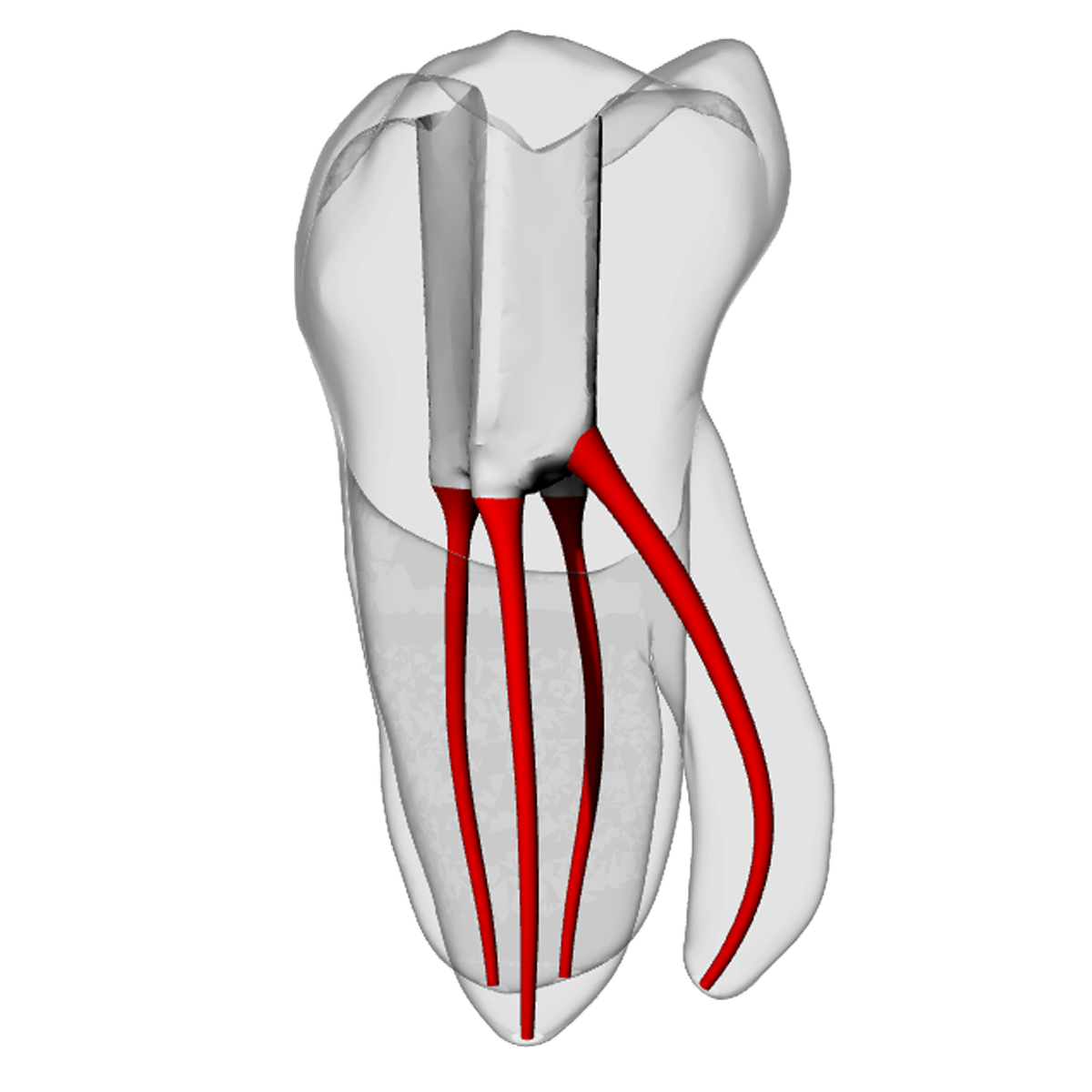 Molar – Radix entomolaris | Dental Training Models | DRSK – DRSK Group AB, Accessories for Root Canal Treatment