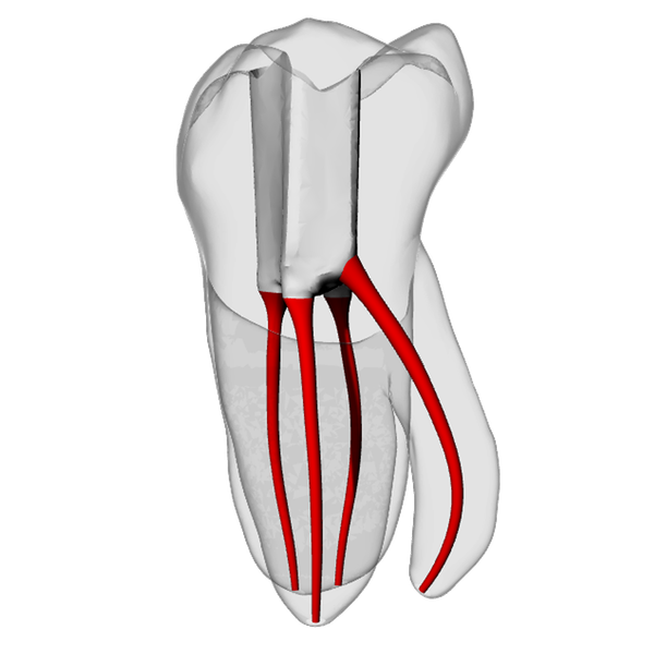 Molar – Radix entomolaris | Dental Training Models | DRSK