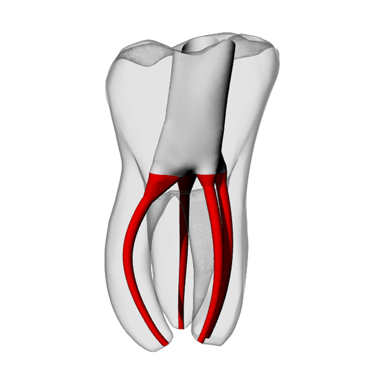 Molar – Accessed, MB2, Moderate Curvature | Dental Training Models | DRSK – DRSK Group AB, Gipszusätze, Stumpflacke und Gipslöser