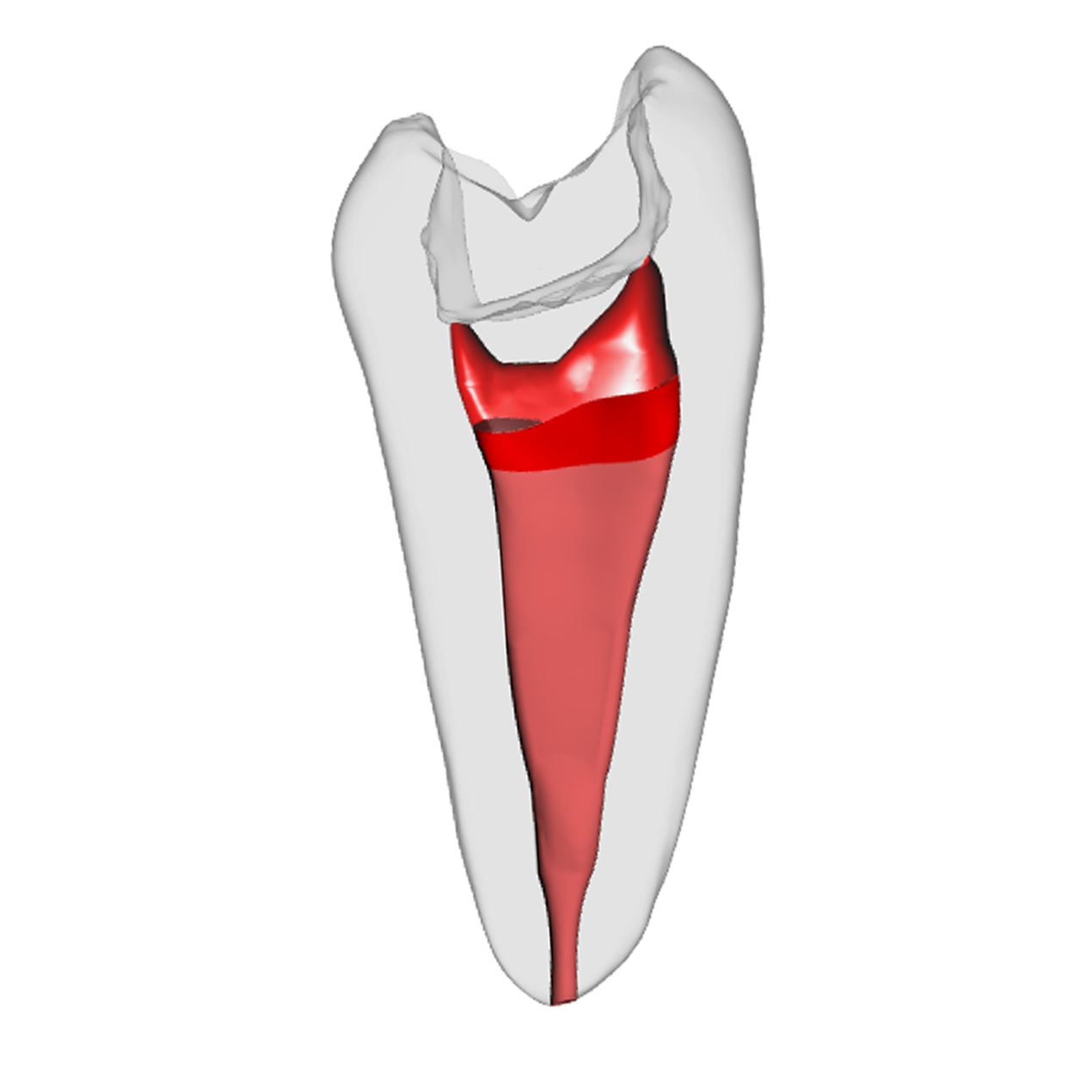 Prämolar - Vitalpulpatherapie, Weiß – DRSK Group AB