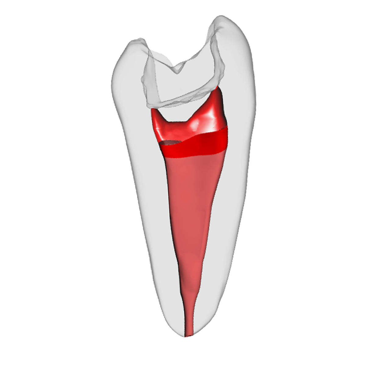 Prämolar - Vitalpulpatherapie, Weiß – DRSK Group AB, Geräte