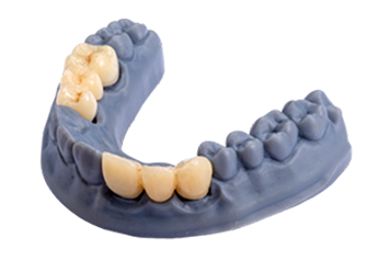 Crown & Bridge Pro – D TECH DENTAL TECHNOLOGIES, Druckharze